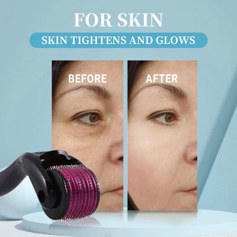 Derma Roller (0.25–3mm size options)