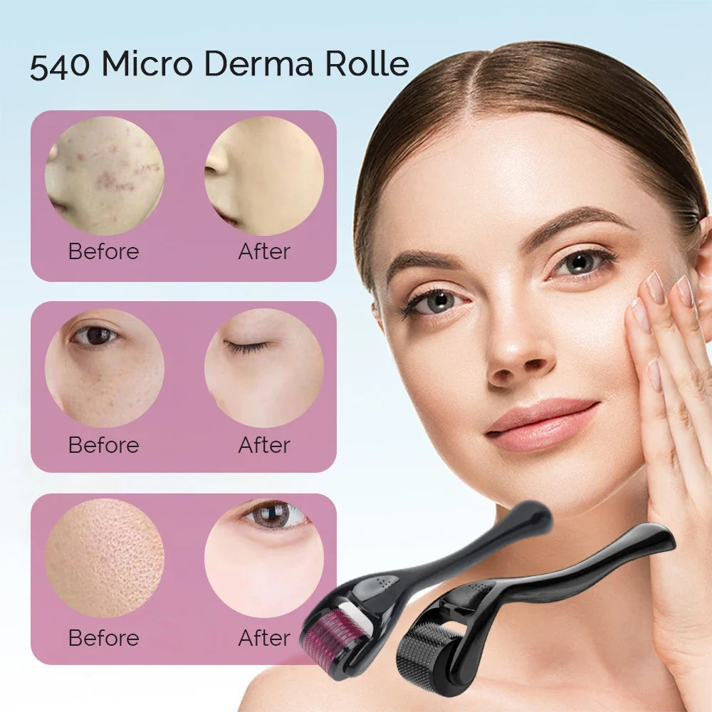 Fine-Needle Derma Roller (1pc)